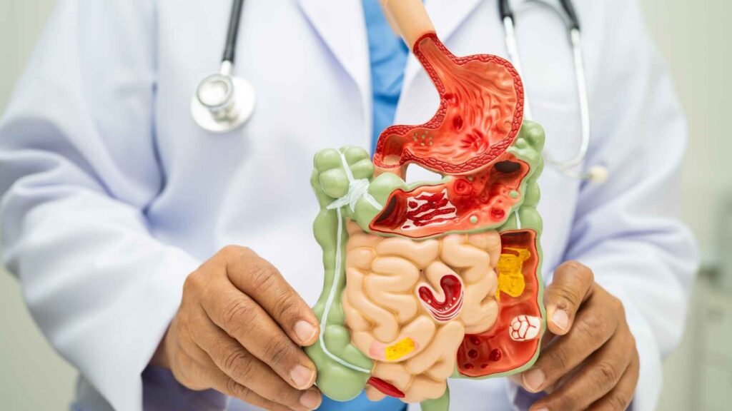 Gut Health